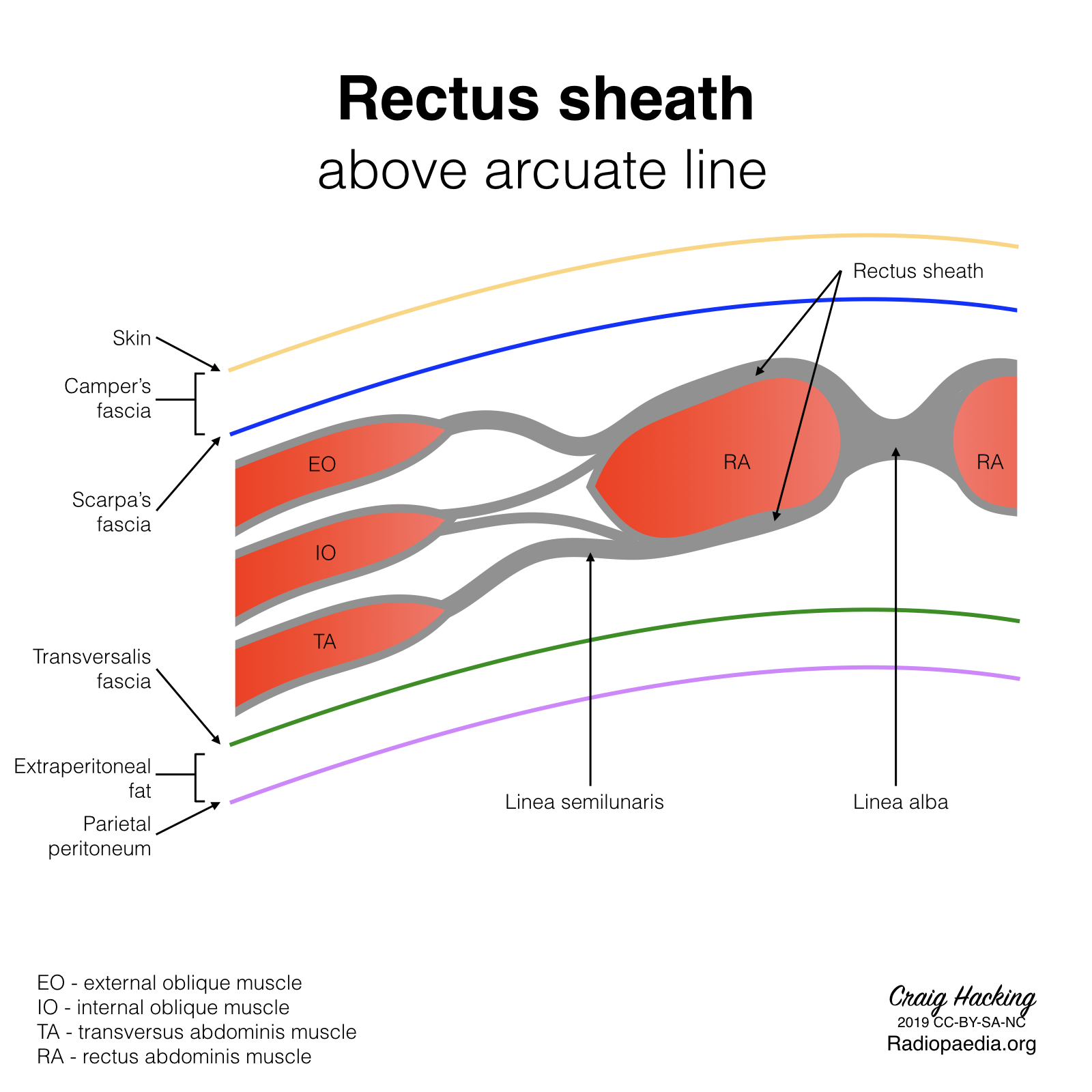 Radiopaedia Drawing Rectus sheath above arcuate line English labels AnatomyTOOL